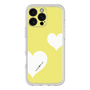 Premium Panel［ Two Hearts - Yellow ］