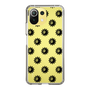 Slim Protection Case［ EVRIS - Sunny Motif - Black ］