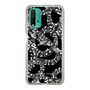 Slim Protection Case［ NUMBER (N)INE - All-Over Musical Notes Pattern ］