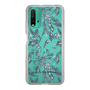 Slim Protection Case［ LAGUNAMOON - BotanicalJacquard - Clear×Black ］