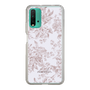 Slim Protection Case［ dazzlin - ToneFlower - Pink ］
