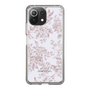 Slim Protection Case［ dazzlin - ToneFlower - Pink ］