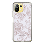 Slim Protection Case［ dazzlin - ToneFlower - Pink ］