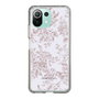 Slim Protection Case［ dazzlin - ToneFlower - Pink ］