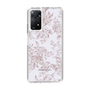 Slim Protection Case［ dazzlin - ToneFlower - Pink ］