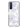 Slim Protection Case［ dazzlin - ToneFlower - Lavender ］
