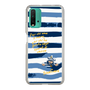 Slim Protection Case［ SINA COVA - Border Stripes ］