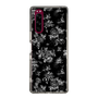 Slim Protection Case［ EATME - Toile de Jouy - Black ］