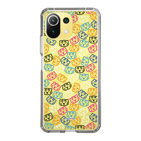 Slim Protection Case［ MUZIK TIGER - Pattern ］