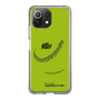 Slim Protection Case［ Nippon Broadcasting System - Show Up Nighter C01 ］