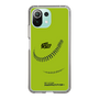 Slim Protection Case［ Nippon Broadcasting System - Show Up Nighter C01 ］