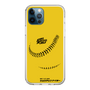 Slim Protection Case［ Nippon Broadcasting System - Show Up Nighter C02 ］