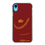 Slim Protection Case［ Nippon Broadcasting System - Show Up Nighter P03 ］