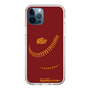 Slim Protection Case［ Nippon Broadcasting System - Show Up Nighter P03 ］