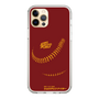 Slim Protection Case［ Nippon Broadcasting System - Show Up Nighter P03 ］