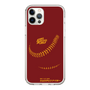 Slim Protection Case［ Nippon Broadcasting System - Show Up Nighter P03 ］