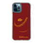 Slim Protection Case［ Nippon Broadcasting System - Show Up Nighter P03 ］