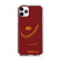 Slim Protection Case［ Nippon Broadcasting System - Show Up Nighter P03 ］