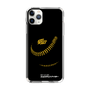 Slim Protection Case［ Nippon Broadcasting System - Show Up Nighter P04 ］