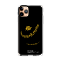 Slim Protection Case［ Nippon Broadcasting System - Show Up Nighter P04 ］