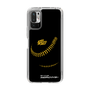 Slim Protection Case［ Nippon Broadcasting System - Show Up Nighter P04 ］