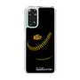 Slim Protection Case［ Nippon Broadcasting System - Show Up Nighter P04 ］
