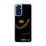 Slim Protection Case［ Nippon Broadcasting System - Show Up Nighter P04 ］