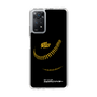 Slim Protection Case［ Nippon Broadcasting System - Show Up Nighter P04 ］