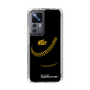 Slim Protection Case［ Nippon Broadcasting System - Show Up Nighter P04 ］