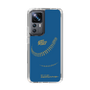 Slim Protection Case［ Nippon Broadcasting System - Show Up Nighter P05 ］