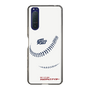 Slim Protection Case［ Nippon Broadcasting System - Show Up Nighter P06 ］