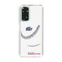 Slim Protection Case［ Nippon Broadcasting System - Show Up Nighter P06 ］