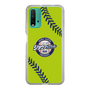 Slim Protection Case［ Nippon Broadcasting System - Show Up Nighter  NC_C01 ］