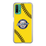 Slim Protection Case［ Nippon Broadcasting System - Show Up Nighter  NC_C03 ］