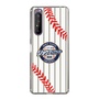 Slim Protection Case［ Nippon Broadcasting System - Show Up Nighter NC_SJ01 ］