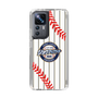 Slim Protection Case［ Nippon Broadcasting System - Show Up Nighter NC_SJ01 ］