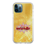 Slim Protection Case［ Nippon Broadcasting System - Fumio Takada's Radio Beverly Lunch Gold ］