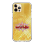 Slim Protection Case［ Nippon Broadcasting System - Fumio Takada's Radio Beverly Lunch Gold ］