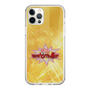 Slim Protection Case［ Nippon Broadcasting System - Fumio Takada's Radio Beverly Lunch Gold ］