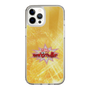 Slim Protection Case［ Nippon Broadcasting System - Fumio Takada's Radio Beverly Lunch Gold ］