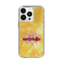 Slim Protection Case［ Nippon Broadcasting System - Fumio Takada's Radio Beverly Lunch Gold ］
