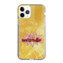 Slim Protection Case［ Nippon Broadcasting System - Fumio Takada's Radio Beverly Lunch Gold ］