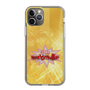 Slim Protection Case［ Nippon Broadcasting System - Fumio Takada's Radio Beverly Lunch Gold ］
