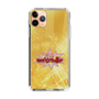 Slim Protection Case［ Nippon Broadcasting System - Fumio Takada's Radio Beverly Lunch Gold ］