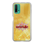 Slim Protection Case［ Nippon Broadcasting System - Fumio Takada's Radio Beverly Lunch Gold ］