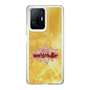 Slim Protection Case［ Nippon Broadcasting System - Fumio Takada's Radio Beverly Lunch Gold ］