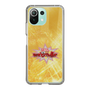 Slim Protection Case［ Nippon Broadcasting System - Fumio Takada's Radio Beverly Lunch Gold ］