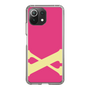 Slim Protection Case［ Original - initial color - X pink ］