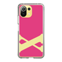 Slim Protection Case［ Original - initial color - X pink ］