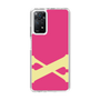 Slim Protection Case［ Original - initial color - X pink ］